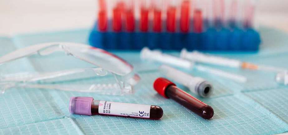 full vials of blood near various medical equipment for taking blood